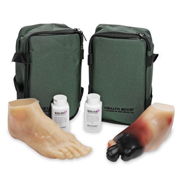Diabetic Foot Model Set | Nasco | Available from LivCor Australia