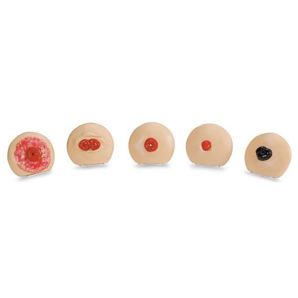 Ostomy Care Training Models Set | Nasco | Available from LivCor Australia