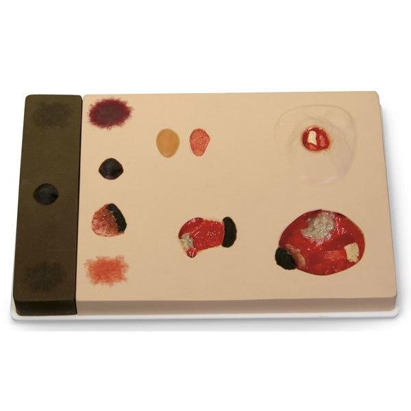 Pat Pressure Ulcer Model | Nasco | Available from LivCor Australia