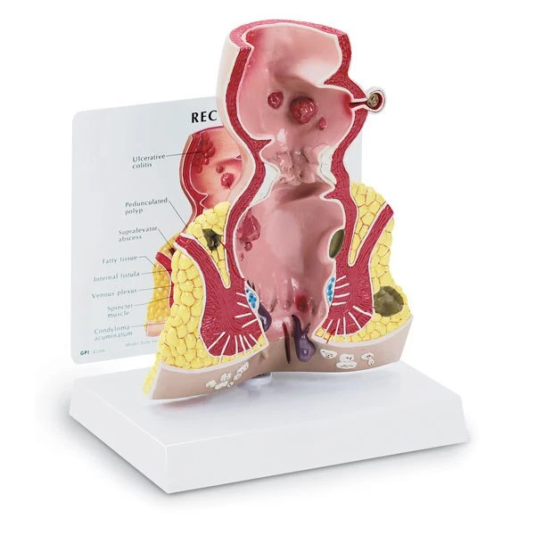Rectum Model | Nasco | Available from LivCor Australia