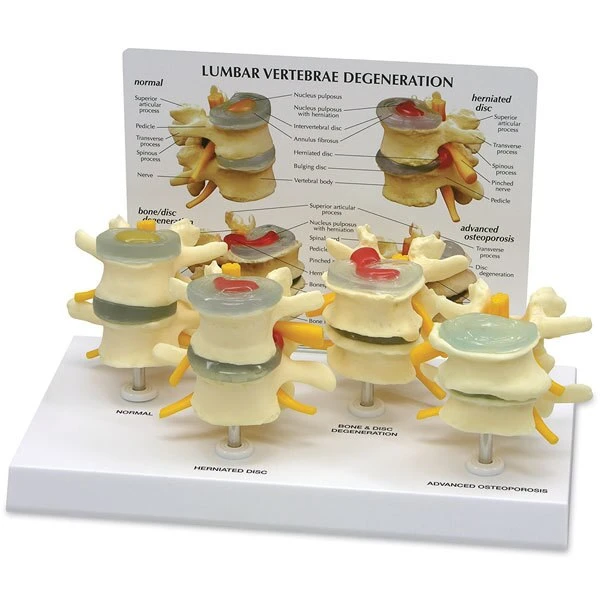 4-Stage Vertebrae Model | Nasco | Available from LivCor Australia