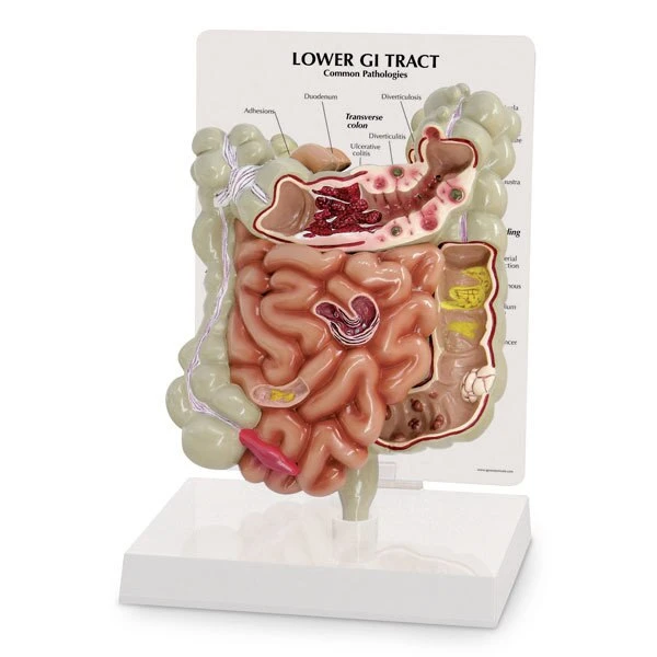 Lower GI Tract Model | Nasco | Available from LivCor Australia