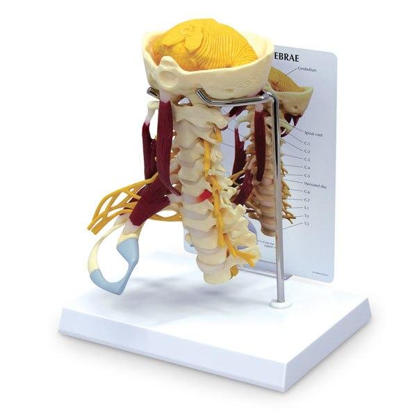 Life-Size Cervical Model with Muscles and Nerves | Nasco | Available from LivCor Australia