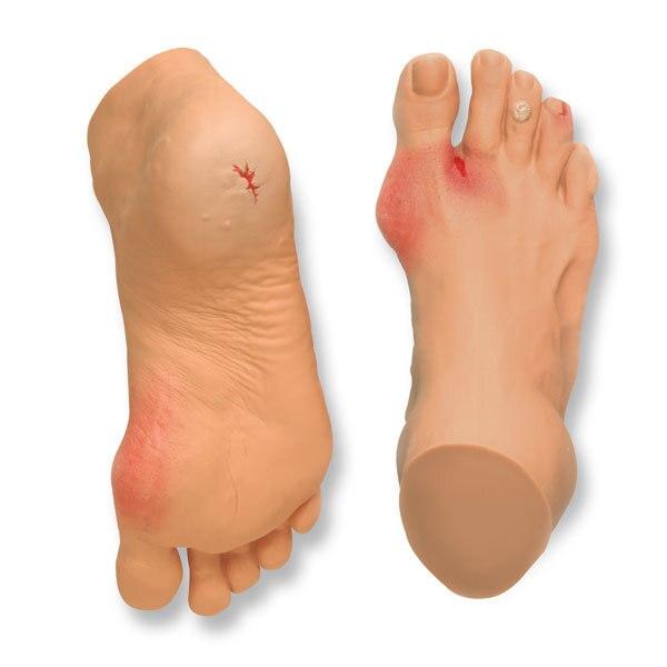 Nasco’s Common Foot Problems | Nasco | Available from LivCor Australia