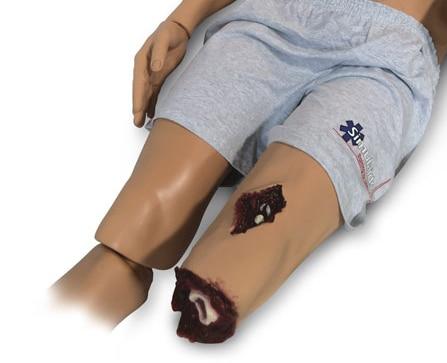 Rescue Randy Upgrade: Leg Flash Moulage | Nasco | Available from LivCor Australia