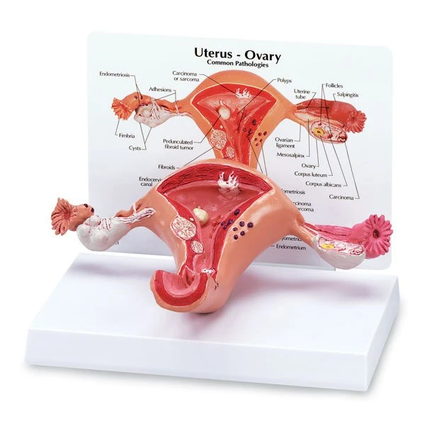 Uterus-Full Size | Nasco | Available from LivCor Australia