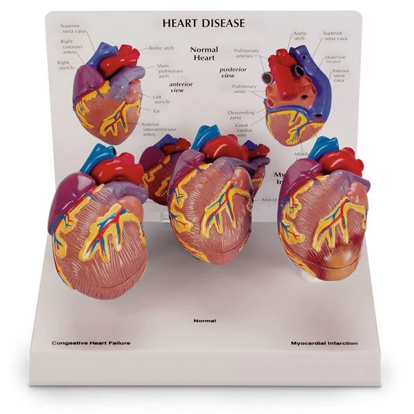 3-Piece Mini Heart Set Models | Nasco | Available from LivCor Australia