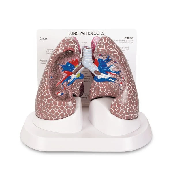 Lung Set with Pathologies | Nasco | Available from LivCor Australia