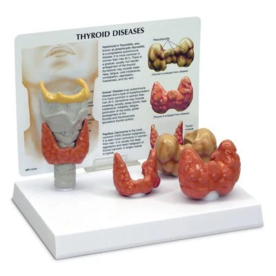 Thyroid Model | Nasco | Available from LivCor Australia