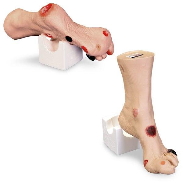 Wilma Wound Foot | Nasco | Available from LivCor Australia