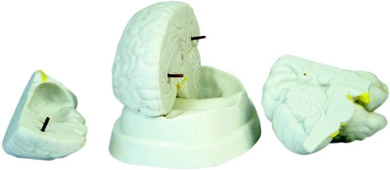 Brain Model | XC Budget Anatomy | Available from LivCor Australia